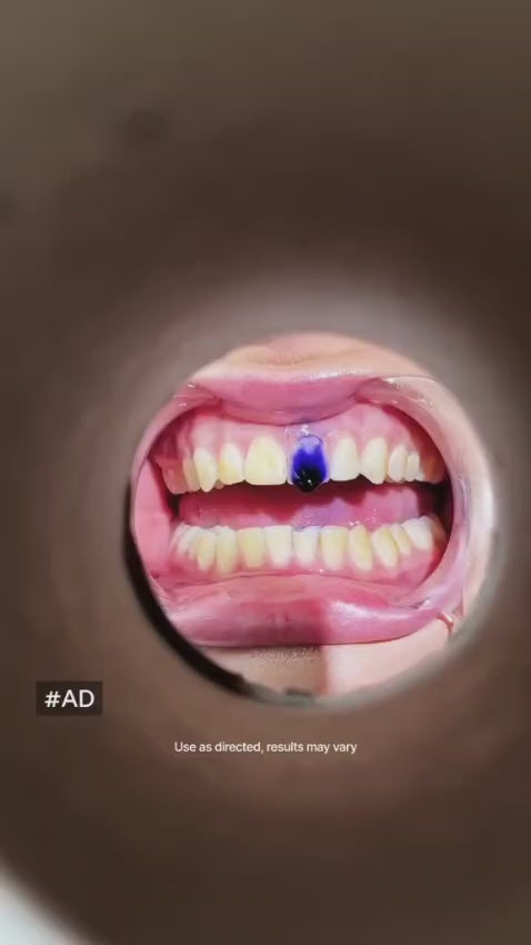 *JD Smile*-50%(Achats avant 00h) Dentifrice ultra blanchissant  livraison GRATUITE